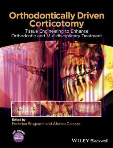 [AME]Orthodontically Driven Corticotomy: Tissue Engineering to Enhance Orthodontic and Multidis...