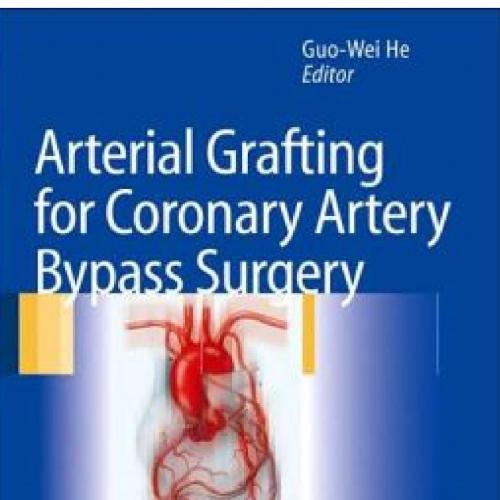 Arterial Grafting for Coronary Artery Bypass Surgery,2nd edition - Wei Zhi