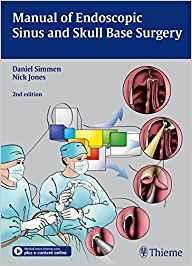Manual of Endoscopic Sinus and Skull Base Surgery