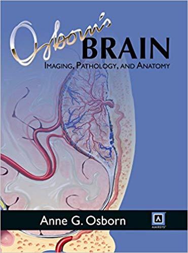 Osborn&rsquo;s Brain - Imaging, Pathology, and Anatomy
