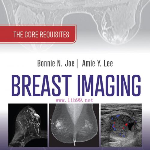 [AME]Breast Imaging The Core Requisites, 4th Edition (PDF)
