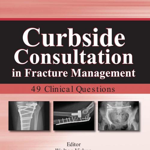 Curbside Consultation in Fracture Management 49 Clinical Questions