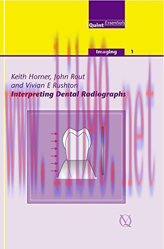 [AME]Interpreting Dental Radiographs (Imaging Vol. 1) (Quintessentials of Dental Practice) (Qui...
