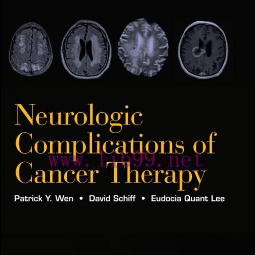 [AME]Neurologic Complications of Cancer Therapy
