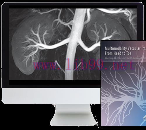 [AME]Multimodality Vascular Imaging: From_ Head to Toe 2020 (CME VIDEOS)
