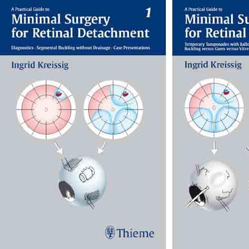 A Practical Guide to Minimal Surgery for Retinal Detachment, Volume I and 2