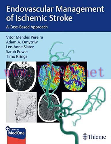 [AME]Endovascular Management of Ischemic Stroke: A Case-Based Approach (Original PDF)