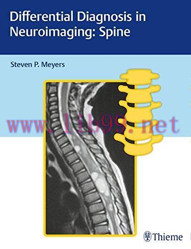 [AME]Differential Diagnosis in Neuroimaging: Spine (PDF)