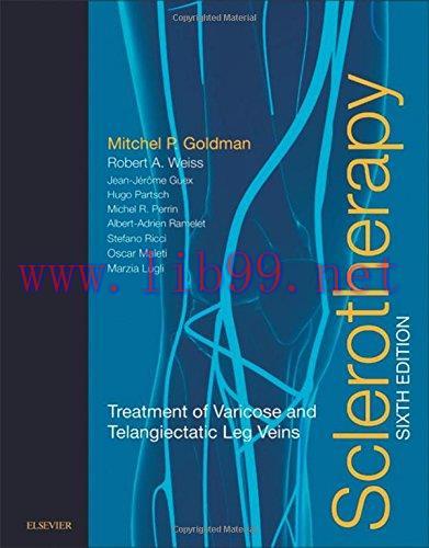 [AME]Sclerotherapy: Treatment of Varicose and Telangiectatic Leg Veins, 6th Edition (Original P...