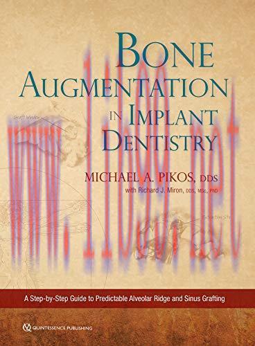 [AME]Bone Augmentation in Implant Dentistry: A Step-by-Step Guide to Predictable Alveolar Ridge...