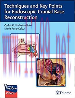 [AME]Techniques and Key Points for Endoscopic Cranial Base Reconstruction (EPUB)