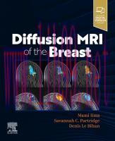 [PDF]Diffusion MRI of the Breast