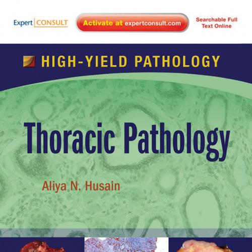 Thoracic Pathology A Volume in the High Yield Pathology Series (Expert Consult - Online and Pri...