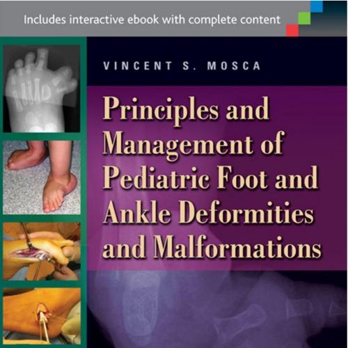 Principles and Management of Pediatric Foot and Ankle Deformities and Malformations
