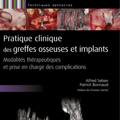 Pratique clinique des greffes osseuses et implants