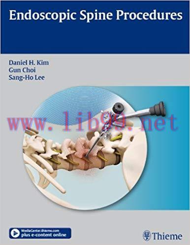 (PDF)Endoscopic Spine Procedures 1st Edition