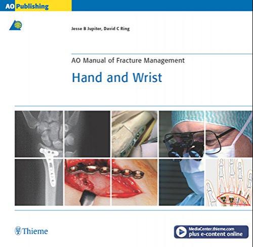 (PDF)AO Manual of Fracture Management Hand & Wrist (AO Manual of Fracture Management Series)
