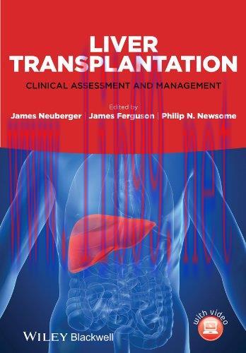 [AME]Liver Transplantation: Clinical Assessment and Management (Original PDF)