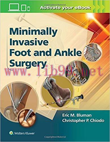 [CHM]Minimally Invasive Foot and Ankle Surgery
