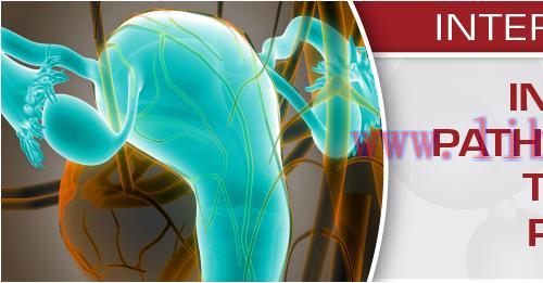 [AME]USCAP Interactive Uterine Pathology - New Entities, Tools & Reporting Recommendations 2020...