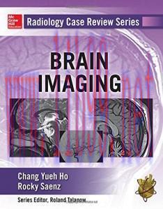 [AME]Radiology Case Review Series: Brain Imaging (EPUB)