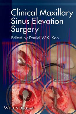 [AME]Clinical Maxillary Sinus Elevation Surgery