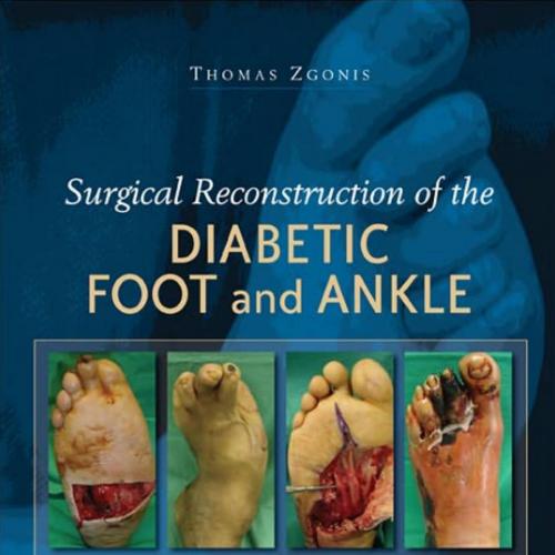 Surgical Reconstruction of the Diabetic Foot and Ankle