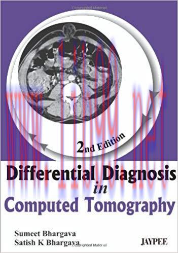 [PDF]Differential Diagnosis in Computed Tomography