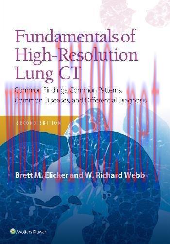 [AME]Fundamentals of High-Resolution Lung CT: Common Findings, Common Patterns, Common Diseases...
