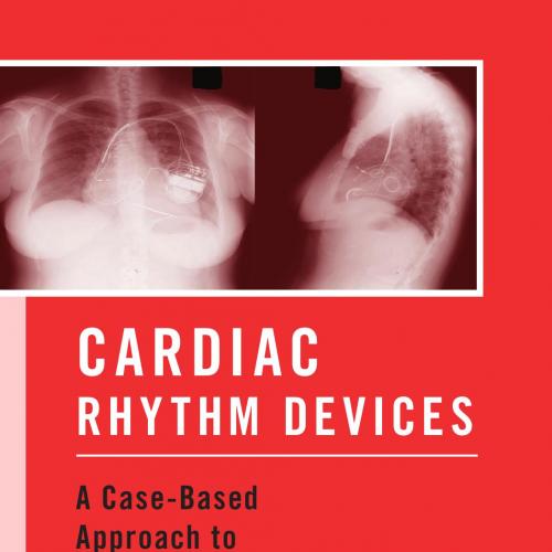 Cardiac Rhythm Devices A Case-Based Approach to Management
