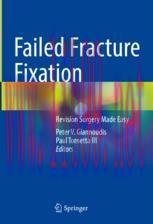 [PDF]Failed Fracture Fixation: Revision Surgery Made Easy