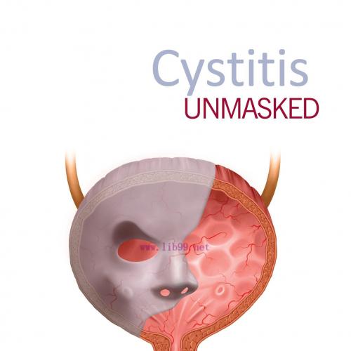 [AME]Cystitis unmasked (Original PDF)