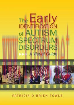 [AME]The Early Identification of Autism Spectrum Disorders: A Visual Guide