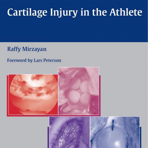 Cartilage Injury in the Athlete