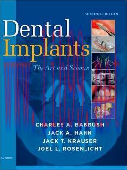 [AME]Dental Implants: The Art and Science, 2nd Edition