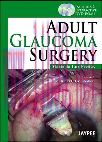 [PDF]Adult Glaucoma Surgery