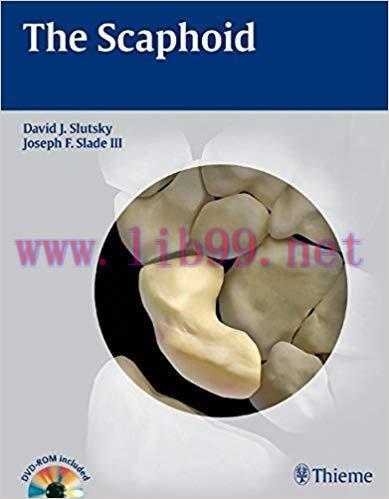 [PDF]The Scaphoid +Videos