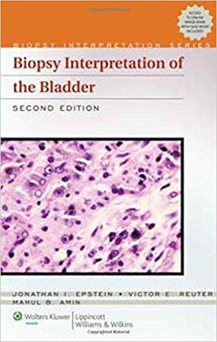 Biopsy Interpretation of the Bladder, 2nd edition