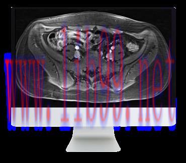 [AME]ARRS A Guide to Bowel Imaging 2019 (CME VIDEOS)