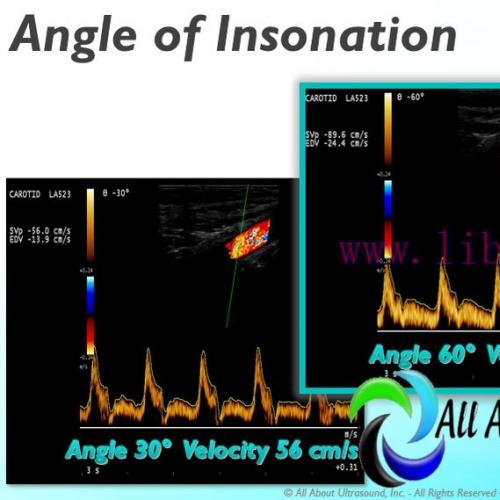 [AME]Mastering Doppler Principles and Hemodynamics- AllAboutUltrasound (Complete HTML)