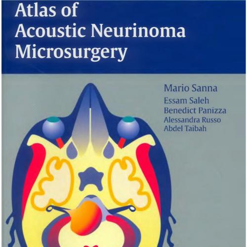 Atlas of Acoustic Neurinoma Microsurgery