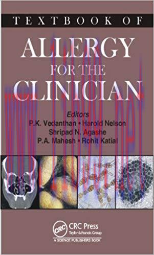(PDF)Textbook of Allergy for the Clinician 1st Edition
