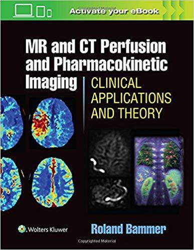 MR and CT Perfusion and Pharmacokinetic Imaging - Clinical Applications and Theoretical Princip...