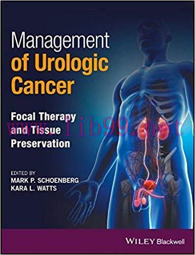 [PDF]Management of Urologic Cancer