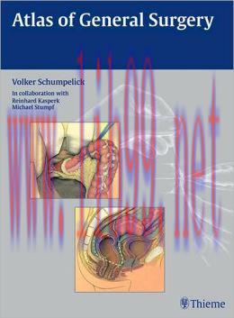 [AME]Atlas of General Surgery (Original PDF)