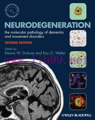 [AME]Neurodegeneration: The Molecular Pathology of Dementia and Movement Disorders, 2e (Origina...