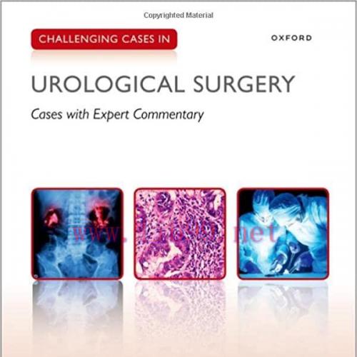 [AME]Challenging Cases in Urological Surgery (Original PDF)