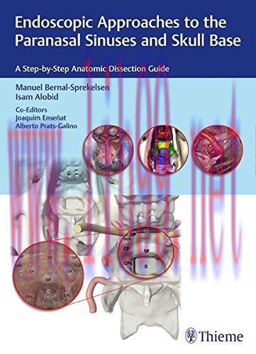[AME]Endoscopic Approaches to the Paranasal Sinuses and Skull Base: A Step-by-Step Anatomic Dis...