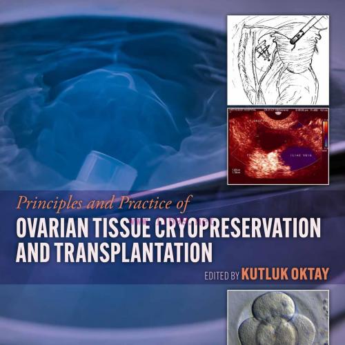 [AME]Principles and Practice of Ovarian Tissue Cryopreservation and Transplantation (EPUB)