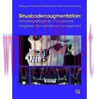 [AME]Sinusbodenaugmentation: Schwierigkeitsgrade, chirurgisches Vorgehen, Komplikationsmanageme...